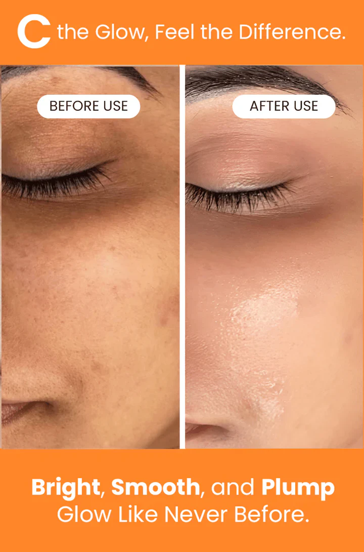C-Glow Vitamin C Serum - Image 4