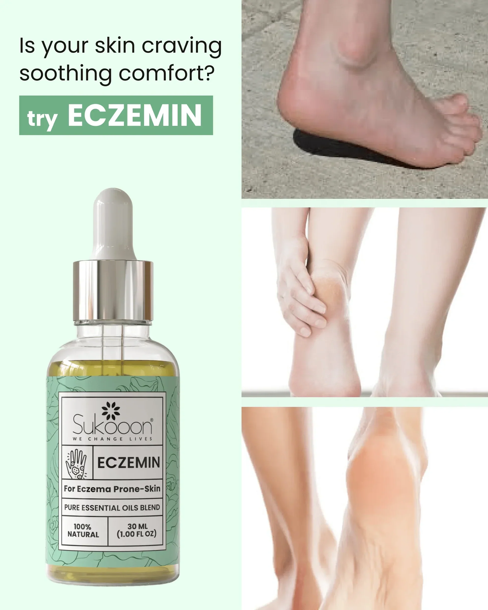 Eczemin Essential Oil 30ml - Image 5