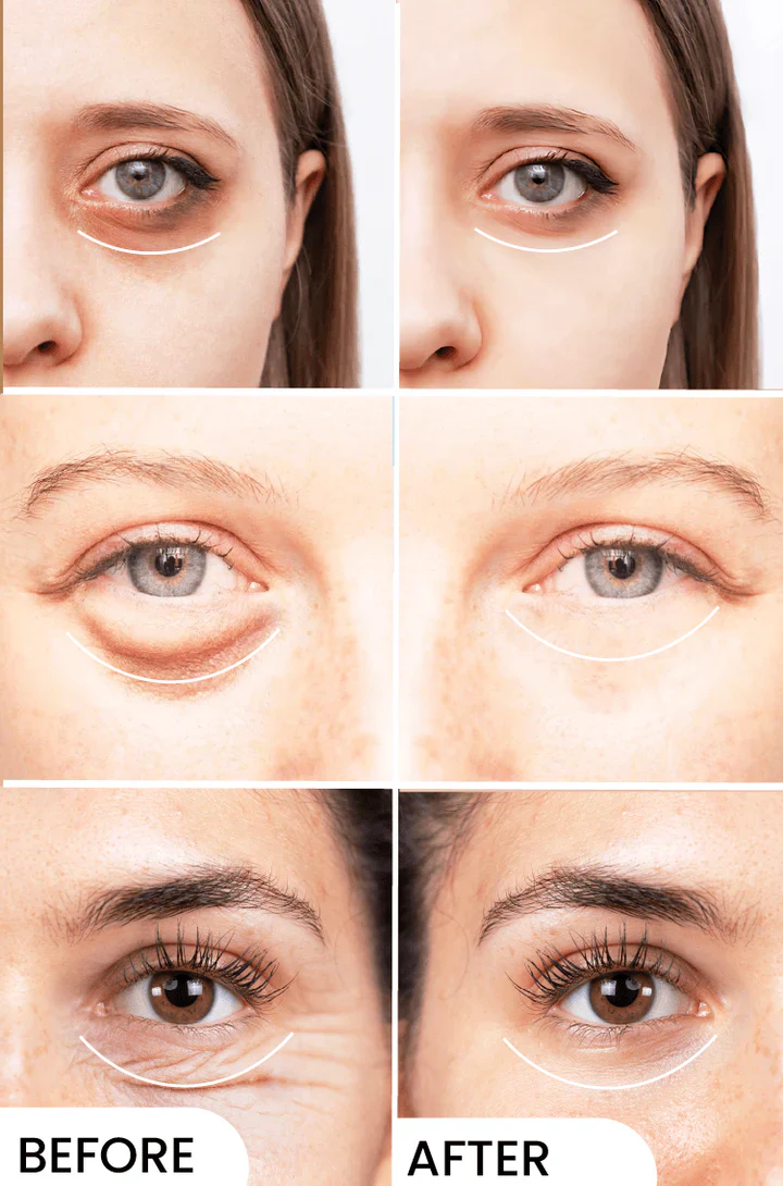 Eyelight | Brightening & Refreshing Eye Area Serum - Image 3